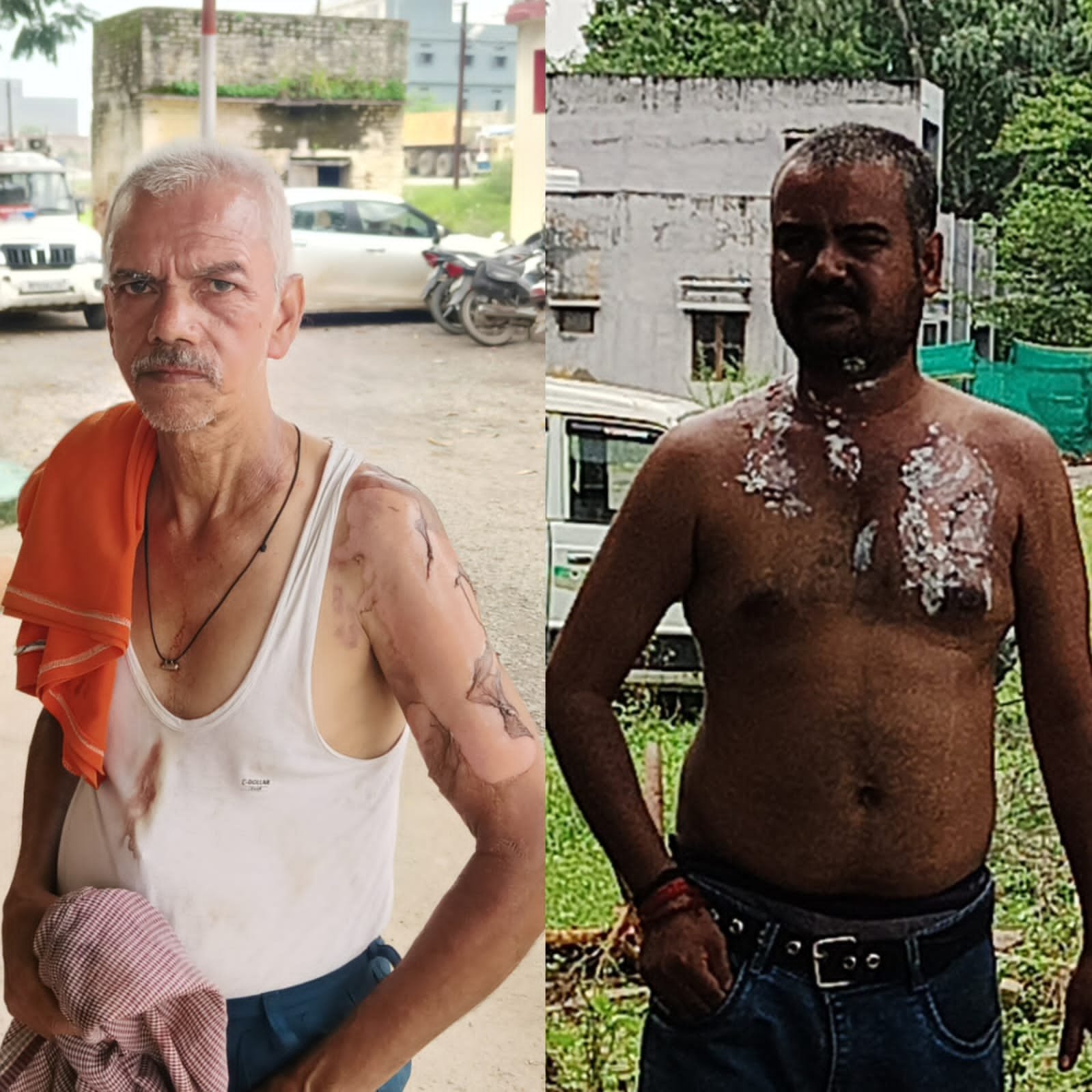 कर्जदार पिता-पुत्र पर डाला खौलता पानी